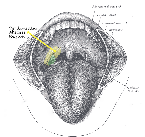 -Figure 41 - Peritonsillar abscess region.png
